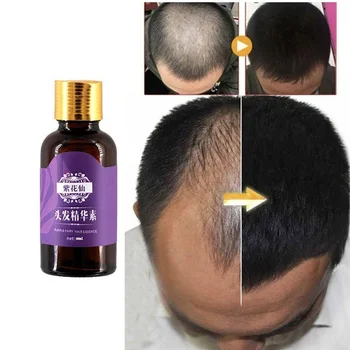 3PCS Plaukų Slinkimas Produktų, Natūralių, be Jokių pašalinių Efektų Augti Plaukai Greičiau Atauga Plaukų Augimo Produktai